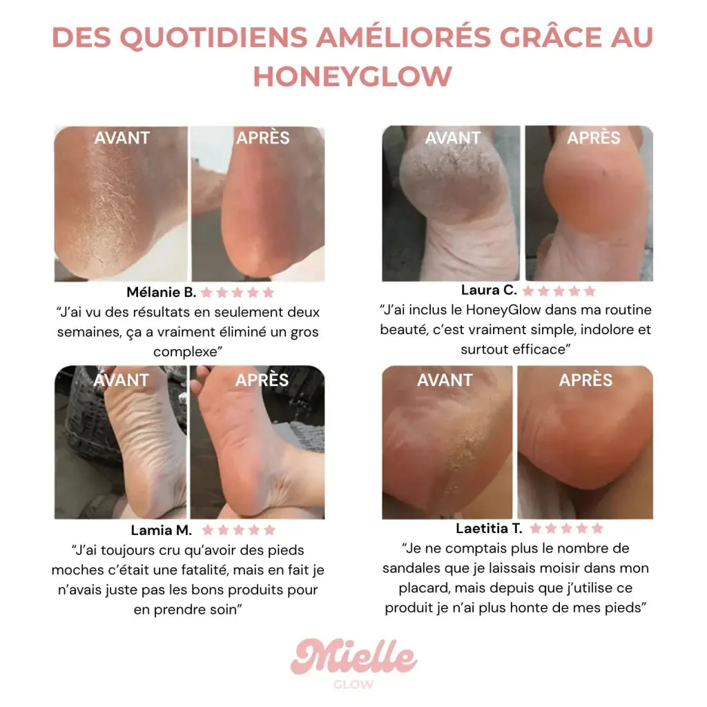 HoneyGlow™ – Kit beauté des pieds