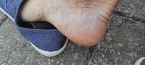 Talons photographiés par Nathalie après sa routine