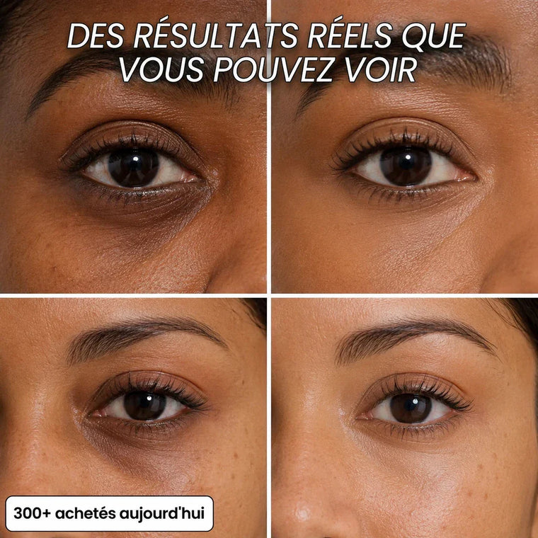 Stick Repulpant 5 % Volufiline, PDRN & Collagène