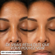 Stick Repulpant 5 % Volufiline, PDRN & Collagène