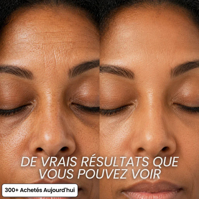 Stick Repulpant 5 % Volufiline, PDRN & Collagène